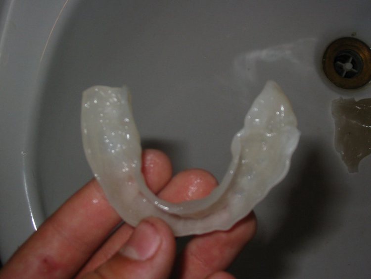 5. How To Make An Orthodontic Retainer