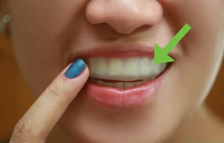 6. How To Make A Fake Retainer Out Of Wax